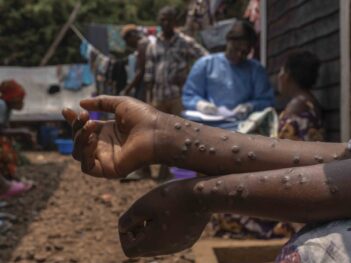 Mpox, HIV/Aids and Africa’s Evolving Pandemic Response — with Winnie Byanyima