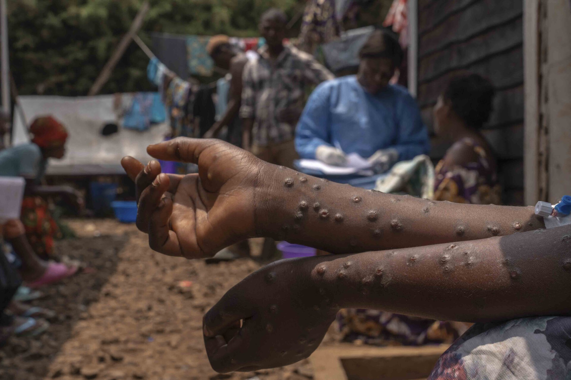 Mpox, HIV/Aids and Africa’s Evolving Pandemic Response — with Winnie Byanyima